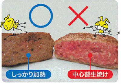腸管出血性大腸菌（O157、O111等）画像